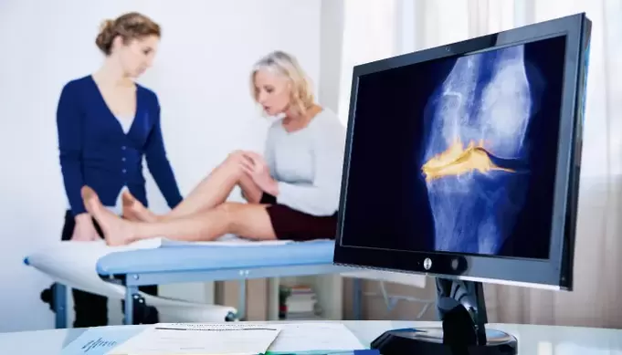 locītavas artroze sievietei