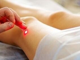 Ceļa locītavas artrozes ārstēšana ar lāzeru